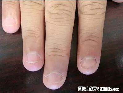 剪指甲、挖耳屎,这些日常小动作竟隐藏大危害! - 佳木斯生活资讯 - 佳木斯28生活网 jms.28life.com